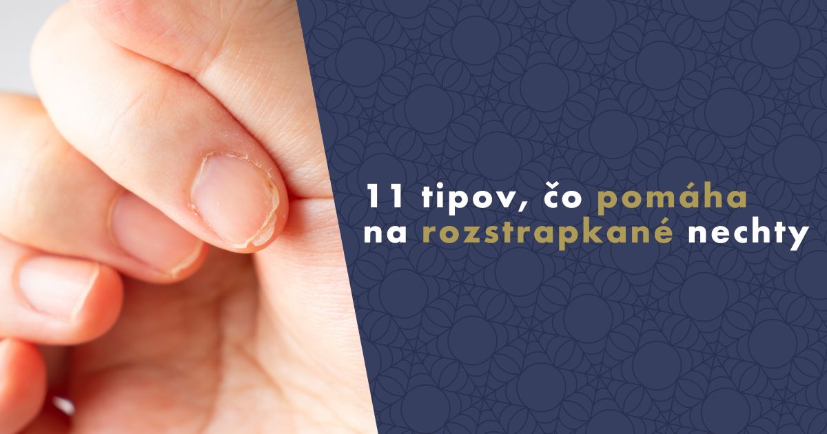 co-pomaha-na-rozstrapkane-nechty (1)